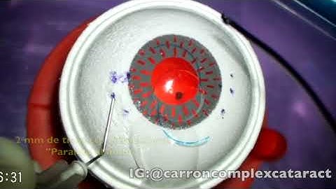 YAMANE´s DOUBLE FLANGE TECHNIQUE. SIMULEYE. step by step