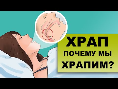 Видео: Вызывает ли лишний вес храп?