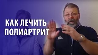 Полиартрит пальцев рук  Симптомы и лечение полиартрита кистей рук(Полиартрит пальцев рук. Хотите знать, как за 10 дней избавиться от полиартрита кистей рук? - http://bit.ly/iridoskanirovanie..., 2015-05-19T06:02:06.000Z)