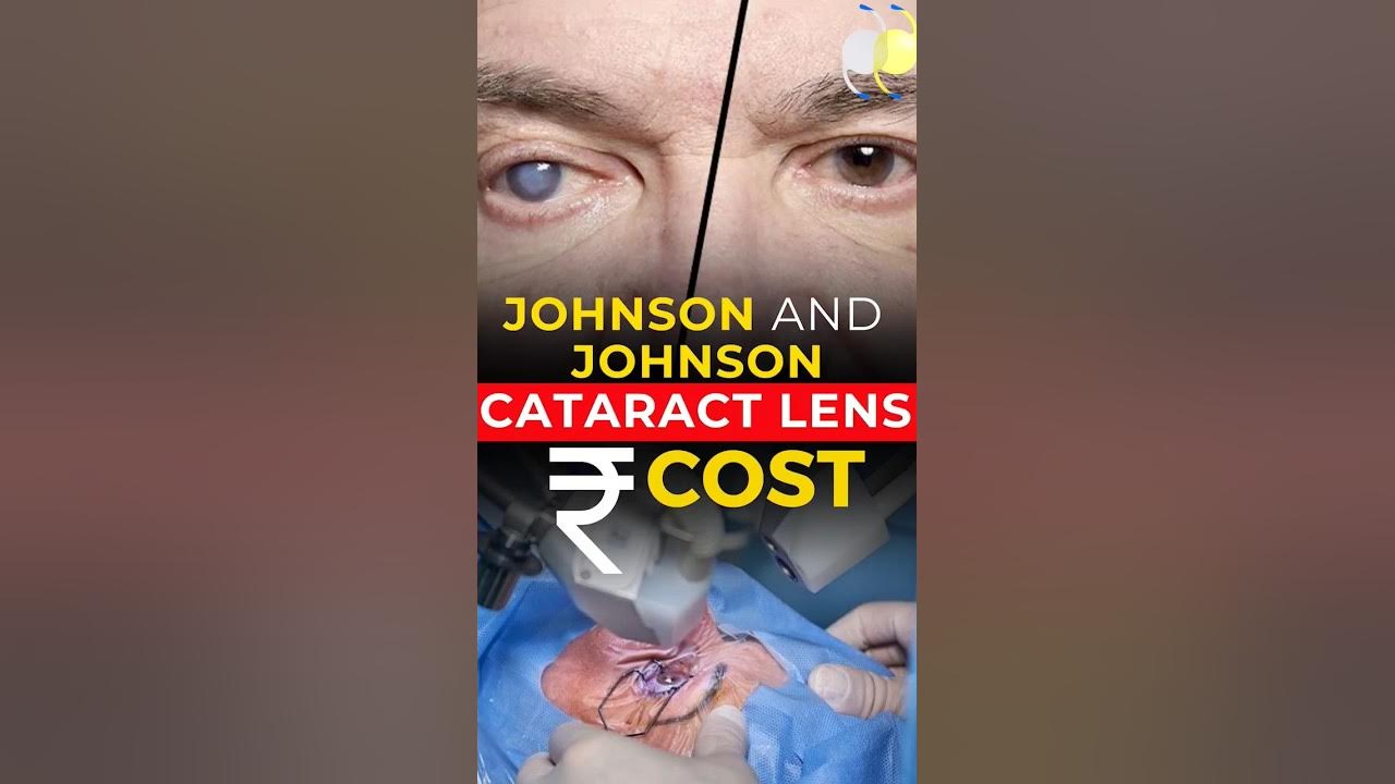 What Is Johnson And Johnson Cataract Lens Cost? - YouTube - Johnson And Johnson Cataract Lens Review