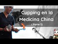 Ventosas ( cupping) en la Medicina China: De la Teoría a la Investigación Moderna ( 5 parte)