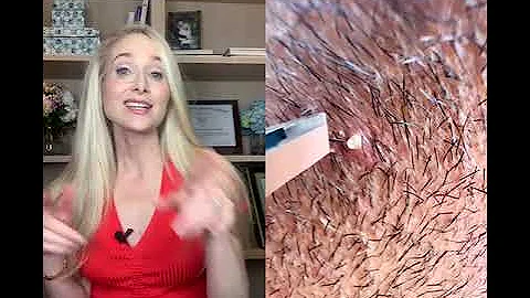 4 DERM TIPS TO PREVENT INGROWN HAIRS #shorts
