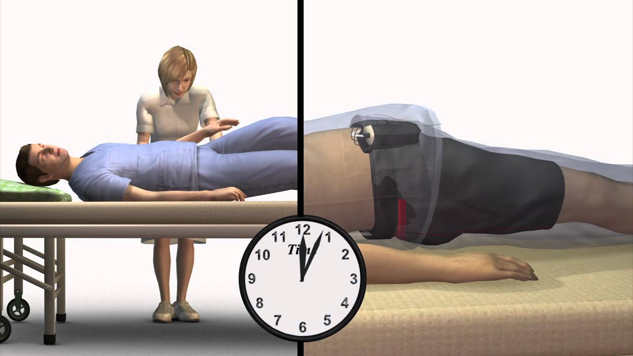 Electric underwear aims to combat bed sores YouTube