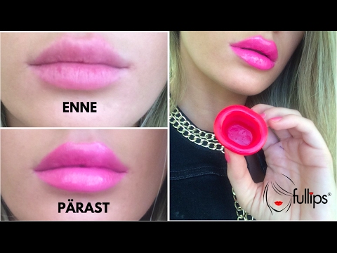 Video: Kuidas koorida huuli: 8 sammu (piltidega)