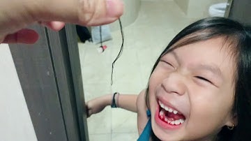 Kỷ Niệm ba Hải nhổ răng Cherry lúc đi quay Lật Mặt 48h tại Cần Thơ | Gia Đình Lý Hải Minh Hà