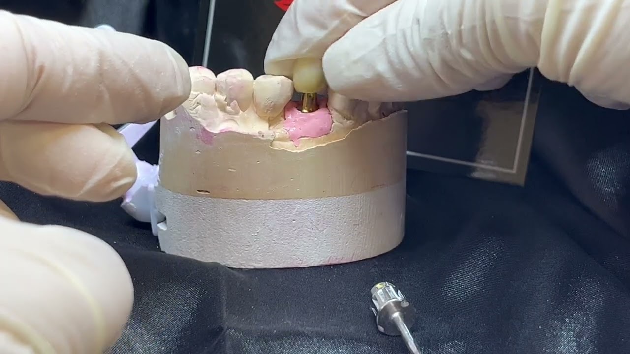 Single Implant Verification Jig