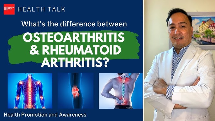 Osteoarthritis vs. rheumatoid arthritis - Mayo Clinic