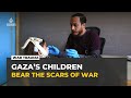 Gaza’s children face lasting trauma as speech loss cases rise