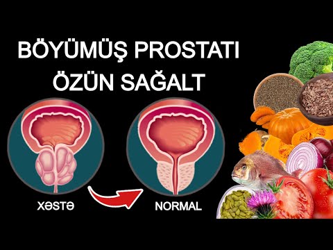 PROSTATIN EVDƏ TƏBİİ MÜALİCƏSİ - Kişilərin 90%-i Bunu Bilmir