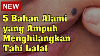 5 Bahan Alami yang Ampuh Menghilangkan Tahi Lalat