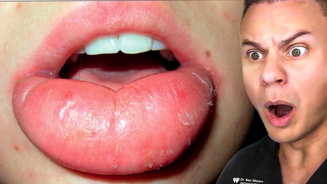 TikToks Your Dentist Warned You About YouTube