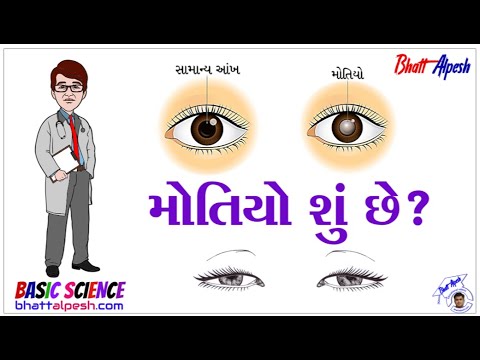 મોતિયો શું છે? | Cataract | સામાન્ય વિજ્ઞાન । Basic Science