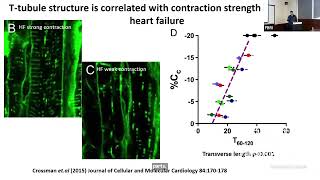 Fibrosis and Aberrant Ca2+ Handling in the Failing Heart