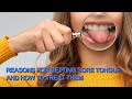 Reasons For Getting Sore Tongue And How To Treat Them Reasons For Getting Sore Tongue And How To Treat Them