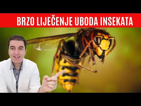 Video: Ugori Insekata - Prva Pomoć Kod Ugriza Otrovnih Insekata, Kako Liječiti Svrbež, Oticanje?