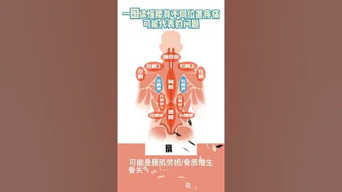 一圖讀懂腰背疼痛的原因A picture to understand the causes of low back pain - 天天要聞