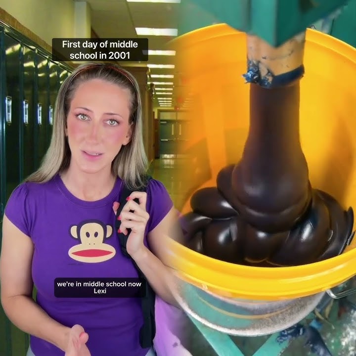 The genesis of my back problems