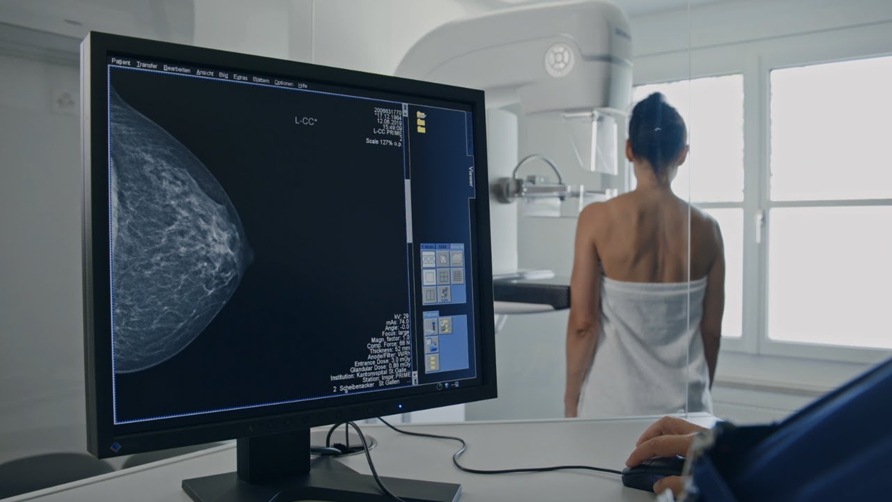 Mammographie wie funktioniert das? YouTube Mammographie wie funktioniert das? YouTube