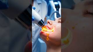 Hybrid Skin Treatments  Micro needling + RF = Game Changer!