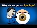 Why do we get an Eye Stye?   more videos | #aumsum #kids #science #education #children