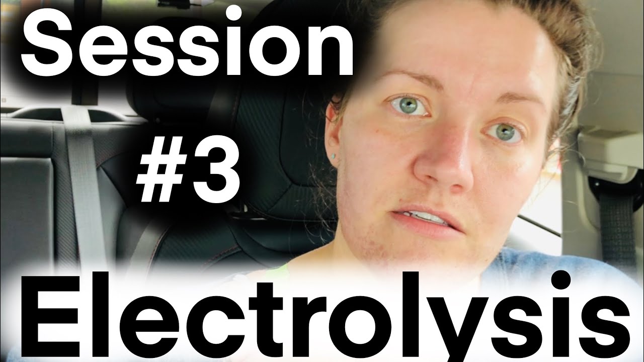 8 HOURS of Electrolysis Permanent Facial Hair Removal PCOS