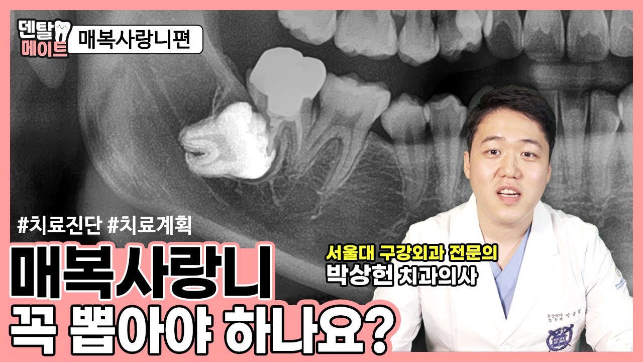 매복사랑니 꼭 뽑아야 하나요?[매복치 진단과 치료방법] | 덴탈메이트