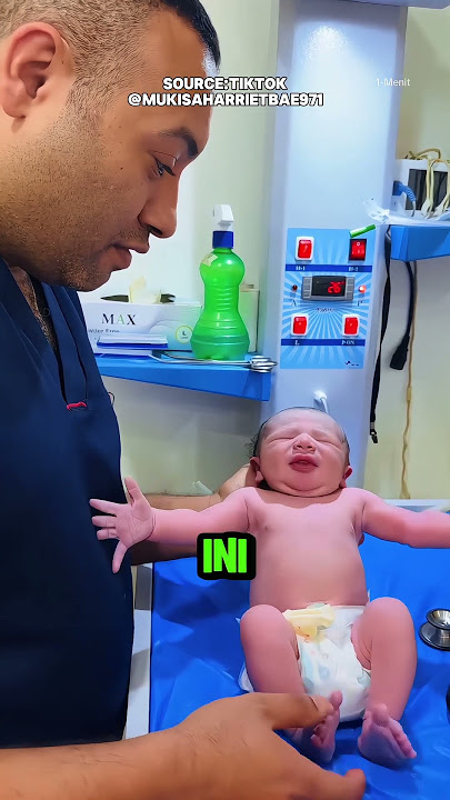 Mengetes Reflek Kaget Pada Bayi yang Baru Lahir! #shorts