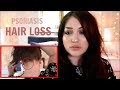 MY HAIR LOSS AND PSORIASIS STORY  ♡