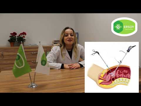 Video: Uterus miyomunun simptomları