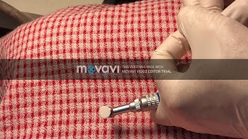 ADC PART 2 EXAM PREP: CLASS 2 COMPLEX COMPOSITE RESTORATION POLISHING AND FINISHING