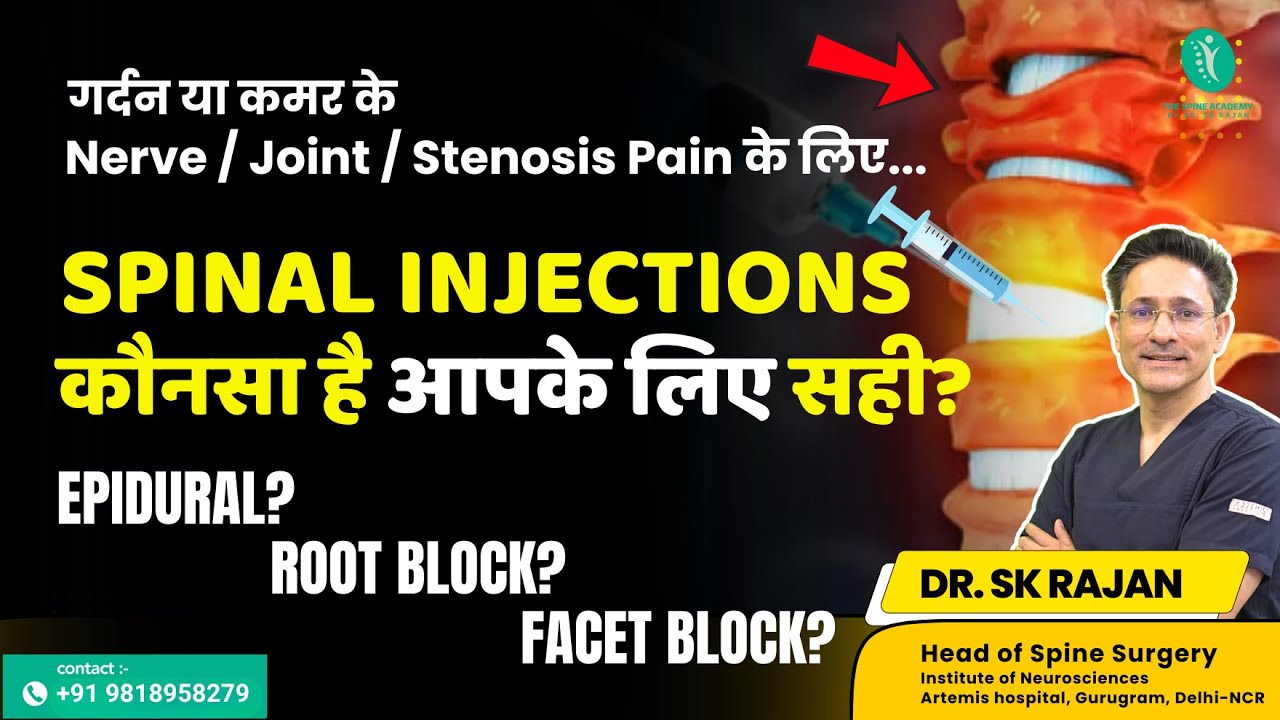 31: Spinal Injections: Epidural, Root Block, Facet - Which one is Right? | हिंदी में | Dr.SK Rajan