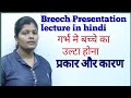 Breech Presentation lecture in hindi || Types of Breech Presentation with Causes and Diagnosis
