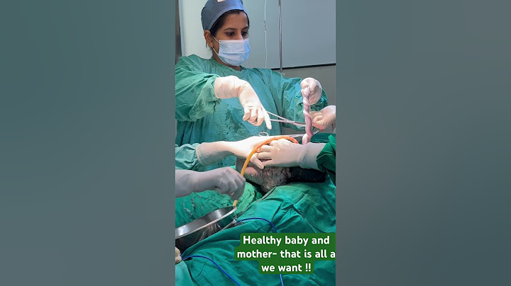 Caesarean delivery of a healthy baby!! #baby #babydelivery #doctor