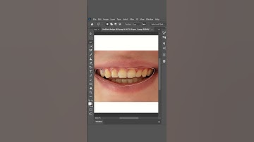 Transform Dirty Teeth to Sparkling White in Photoshop | Easy Tutorial#shorts