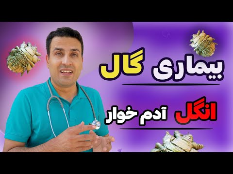گال انگل آدم خوار آنچه باید در مورد انگل گال بدونید تشخیص و درمان فوری بیماری پوستی گال راه انتقال