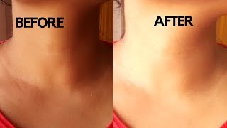 How To Get Rid Of Dark Neck in 15 Minutes | Home Remedy to Remove Darkness from Neck