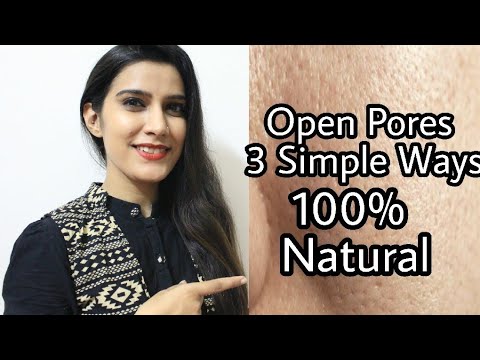 खुले रोम छिद्रों को कैसे बंद करें ?? Open Pores Treatment at home | 100% Natural Effective |