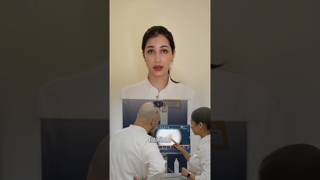 Как проверить родинки за 60 секунд