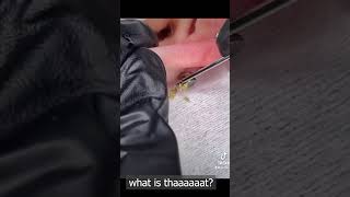 pimple popping 2022 new, blackheads on nose, pimple popping tiktok 53RWW