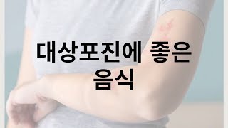 대상포진에 좋은 음식 재발하지 않도록 면역관리 중요