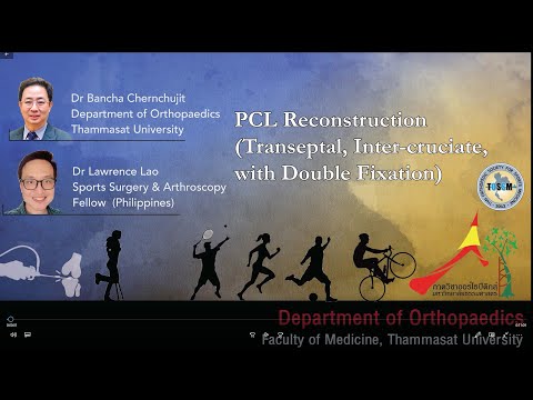 PCL Reconstruction Remnant Preservation Aperture fixation Internal Bracing เอ็นไขว้หลังหัวเข่าฉีกขาด