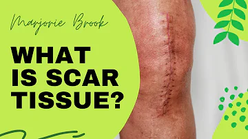 What is Scar Tissue