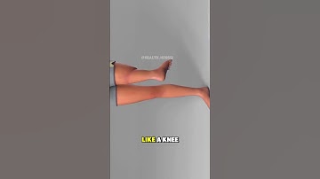 RotationPlasty #legs #3d