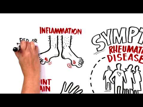 Video: Koľko je u nás reumatológov?