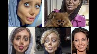 19 Year Old Iranian Teenager Shahar Tabar Under Gone 50 Surgeries To Look Like Angelina Jolie