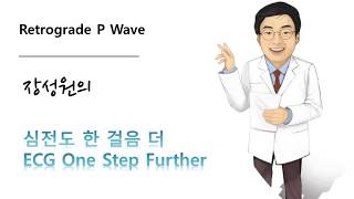 심전도 한 걸음 더 04. Retrograde P wave  역행성 P파
