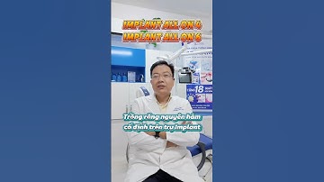 ✅IMPLANT ALL ON 4 - IMPLANT ALL ON 6 #NhaKhoaTuongMinh #Implant #Implantallon4 #shorts #suckhoe