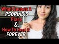 WHAT CAUSES A PSORIASIS FLARE & HOW TO HEAL IT FAST