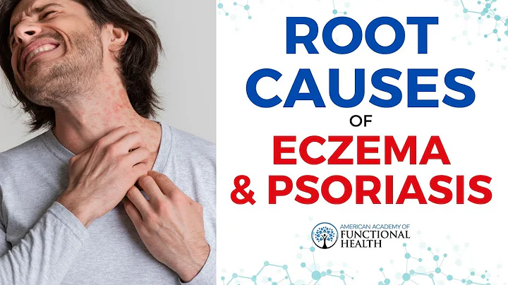 The Gut-Skin Axis | Eczema & Psoriasis Root Causes