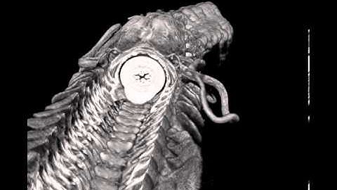 Micro-CT scan of Phyllodoce lineata (Polychaeta, Phyllodocidae)